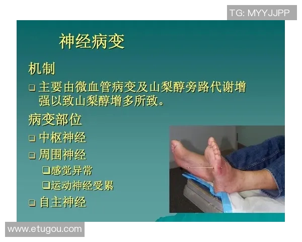 足球明星与糖尿病的斗争:如何在运动与健康之间找到平衡 足球明星与糖尿病的斗争:如何在运动与健康之间找到平衡